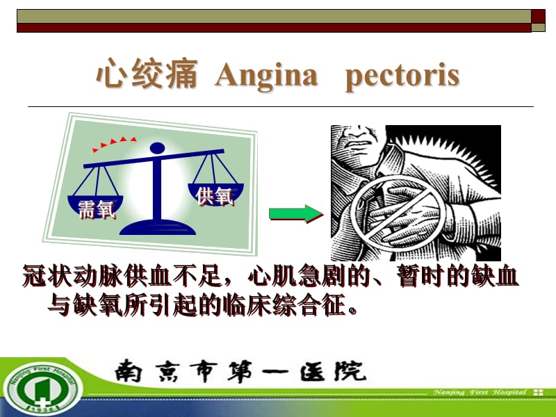 心绞痛的最新分型,心绞痛的最新分型，观点阐述