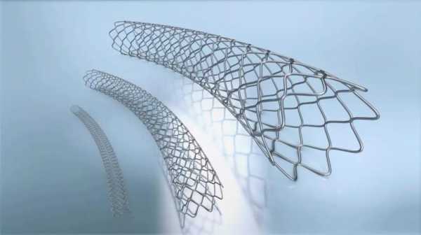 2023年心脏支架最新价格